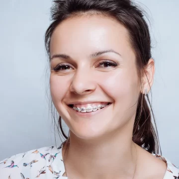 Unknown Facts about Clear Aligners Braces in Bayport