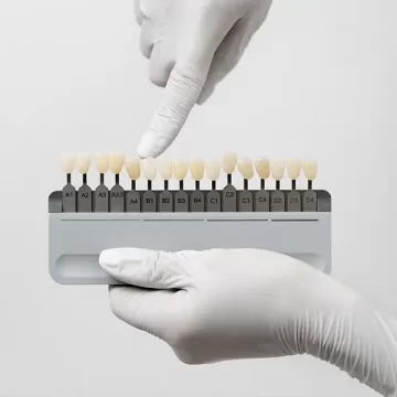 Common Myths about Veneers