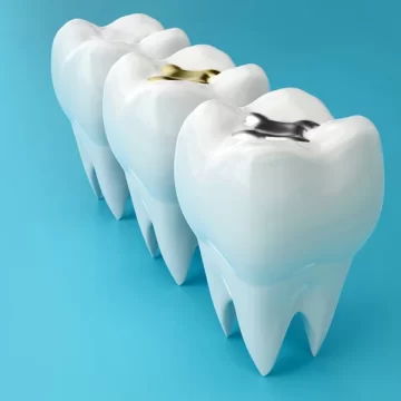 Dental Fillings in Bayport, NY: What They Are and How They Protect Your Teeth